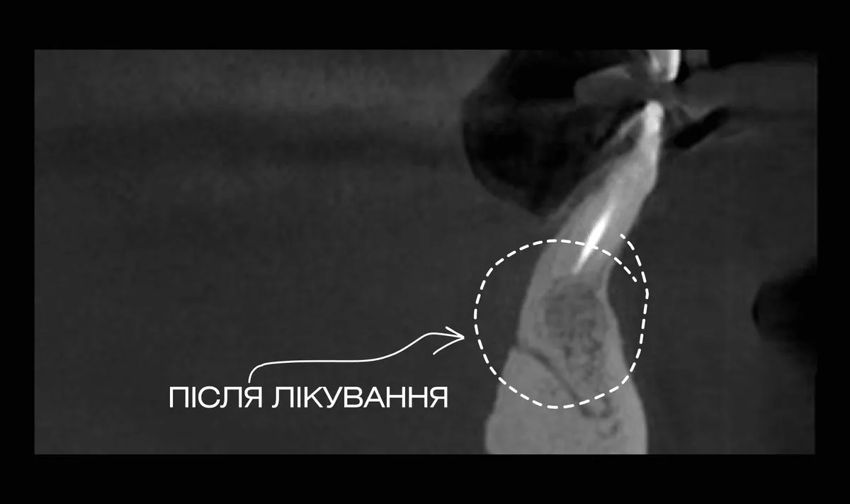 После