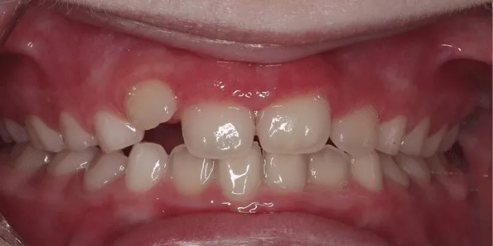 До